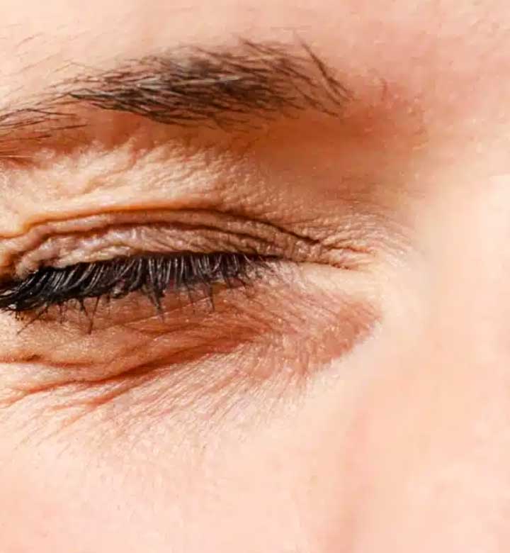 Göz seğirmesi için evde yapabilecekleriniz